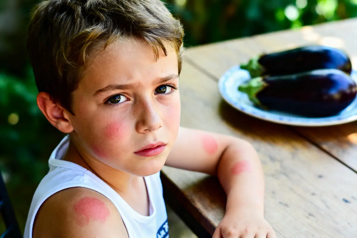 Enfant avec éruptions cutanées près d'aubergines aide à reconnaître une allergie aux aubergines